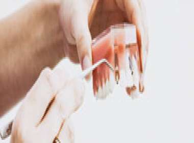 Assistenza odontoiatrica, indicazioni per la presa in carico del paziente con bisogni speciali