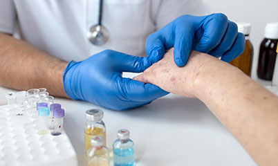 La Micosi dermatite fungina come fare